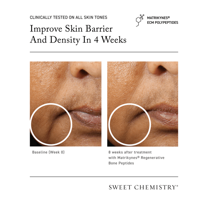 Elasticity Reinforcing Lipid-Cream