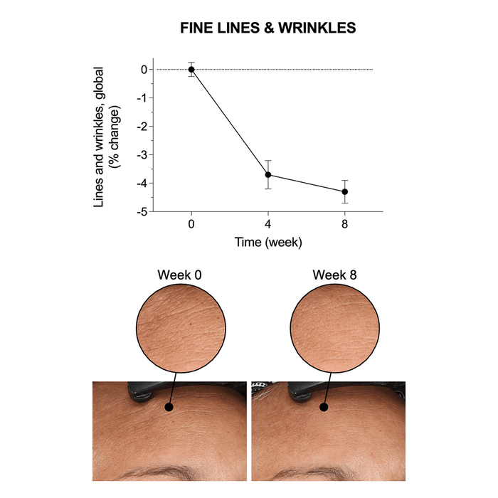 Elasticity Reinforcing Lipid-Cream
