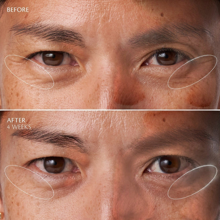 Eye Contour Cream Supreme
