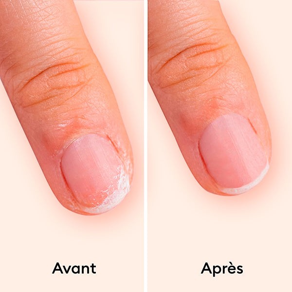 Nail Strengthening Serum