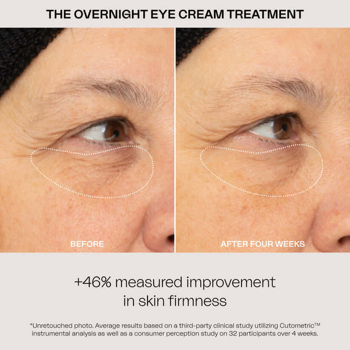 The Overnight Eye Cream Treatment